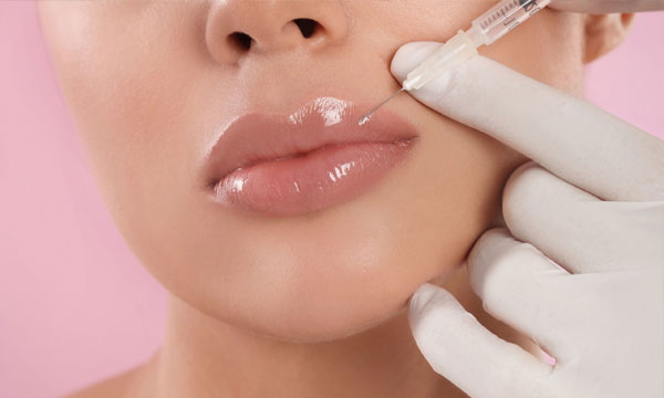 Dermal filler treatment